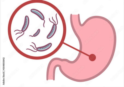 食道カンジダ症