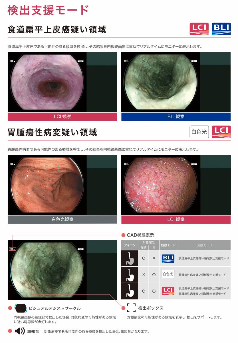 検出支援モード