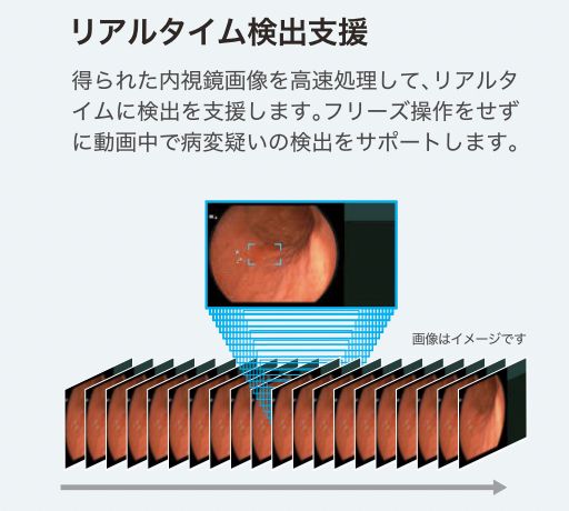 リアルタイム検出支援